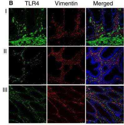 Immunohistochemistry: TLR (Cell Surface) Screening Antibody Pack [NBP2-25086]