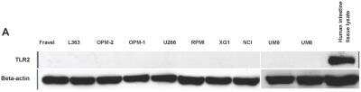 Western Blot: TLR (Cell Surface) Screening Antibody Pack [NBP2-25086]