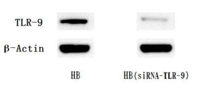 Knockout Validated: TLR Screening Antibody Pack [NBP2-25083]