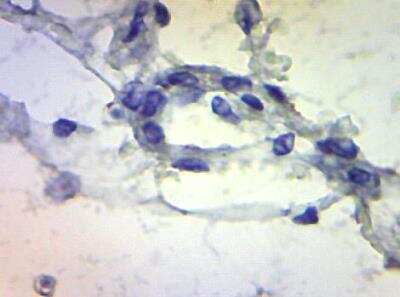 Immunohistochemistry: TLR1 Antibody [NBP3-12355]