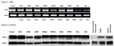Western Blot: TLR1 Antibody [NB100-56563]