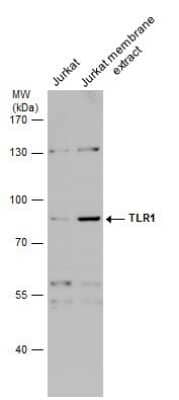 Western Blot: TLR1 Antibody [NBP3-12901]