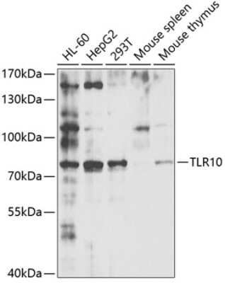 Western Blot: TLR10 AntibodyBSA Free [NBP2-94460]