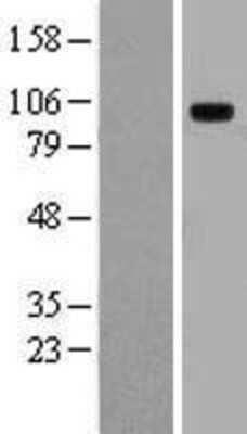 Western Blot: TLR10 Overexpression Lysate [NBL1-16951]