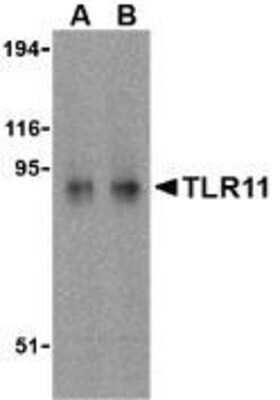 Western Blot: TLR11 AntibodyBSA Free [NBP1-77204]