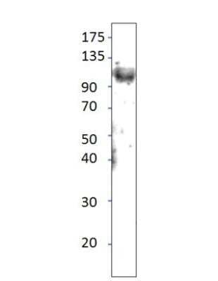 Western Blot: TLR11 Antibody [NBP3-12500]