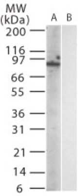 Western Blot: TLR12 Antibody (15F1215) [NBP2-24870]