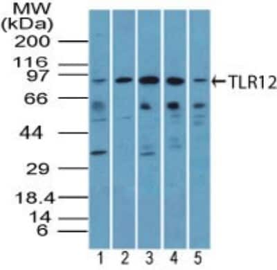 Western Blot: TLR12 Antibody [NBP2-24833]