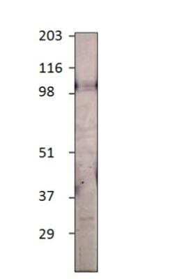 Western Blot: TLR12 Antibody [NBP3-12501]