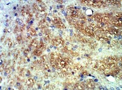 Immunohistochemistry-Paraffin: TLR13 Antibody [NBP3-12357]