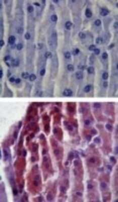 Immunohistochemistry: TLR2 Antibody - Azide Free [NBP2-24861]