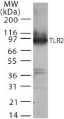 Western Blot: TLR2 AntibodyAzide Free [NBP2-24861]