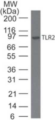 Western Blot: TLR2 Antibody (11G5)BSA Free [NBP2-27165]