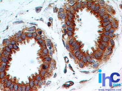 Immunohistochemistry-Paraffin: TLR2 Antibody (67N17F8) [NBP2-25244]