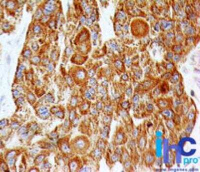 Immunohistochemistry-Paraffin: TLR2 Antibody (67N8F8) [NBP2-25245]