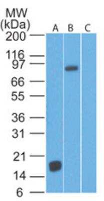 Western Blot: TLR2 Antibody (67N8F8) [NBP2-25245]