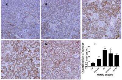 Immunohistochemistry: TLR2 Antibody [NB100-56720]