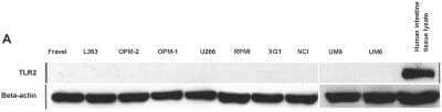 Western Blot: TLR2 Antibody (TL2.1)BSA Free [NB100-56722]