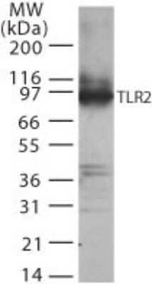Western Blot: TLR2 Antibody [NB100-56720]