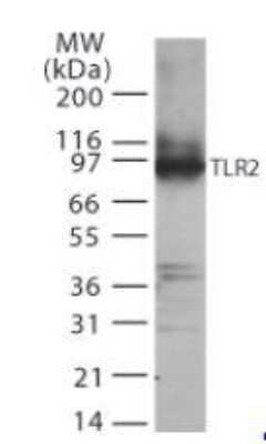 Western Blot: TLR2 Cell Lysate [NBP2-25060]