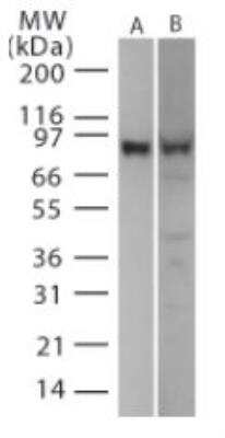 Western Blot: TLR2 Cell Lysate [NBP2-30165]