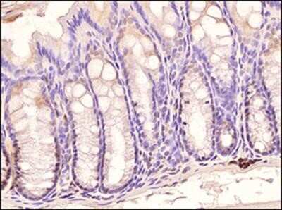 Immunohistochemistry: TLR3 Antibody (40C1285.6) - Azide Free [NBP2-33263]