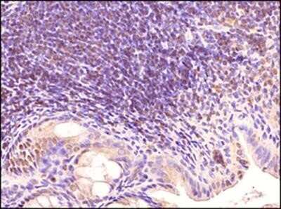 Immunohistochemistry: TLR3 Antibody (40C1285.6) - Azide Free [NBP2-33263]