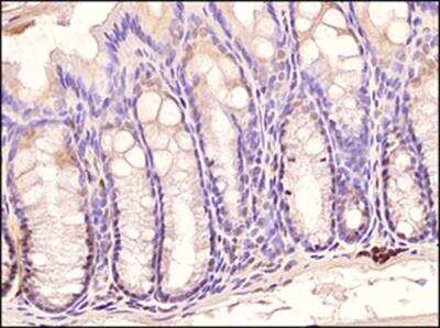 Immunohistochemistry-Paraffin: TLR3 Antibody (40C1285.6) - BSA Free [NBP2-24875]