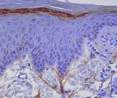 Immunohistochemistry-Paraffin: TLR3 Antibody (619F7.06) [DDX0470P-100]