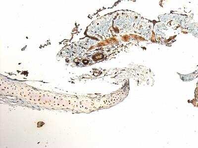 Immunohistochemistry: TLR3 Antibody [NB100-56571]
