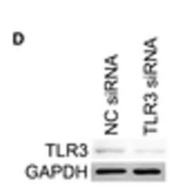 Knockdown Validated: TLR3 Antibody [NB100-56571]