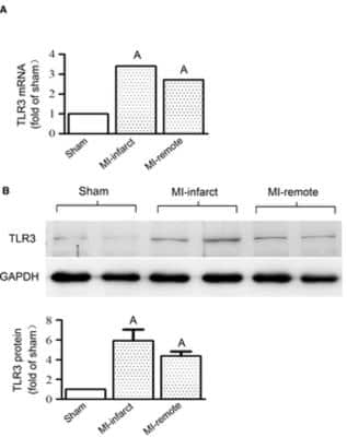 Western Blot: TLR3 Antibody [NB100-56571]