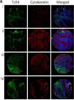 Immunohistochemistry: TLR4 Antibody (76B357.1) - Azide Free [NBP2-27149]