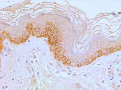 Immunohistochemistry: TLR4 Antibody (76B357.1) - Azide Free [NBP2-27149]