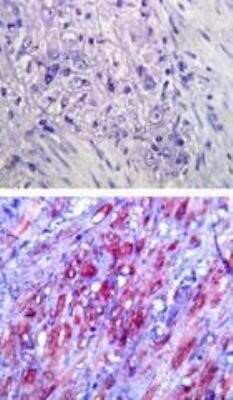 Immunohistochemistry-Paraffin: TLR4 Antibody (76B357.1) - Azide Free [NBP2-27149]