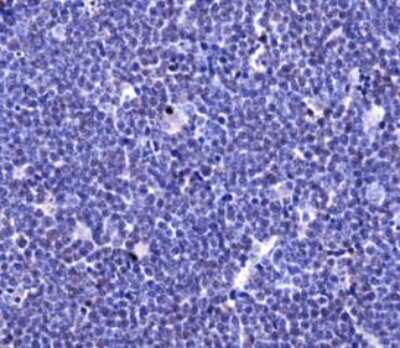 Immunohistochemistry: TLR4 Antibody - BSA Free [NBP1-78427]