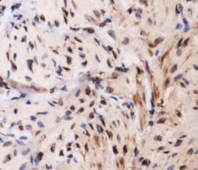 Immunohistochemistry: TLR4 Antibody - BSA Free [NBP1-78427]
