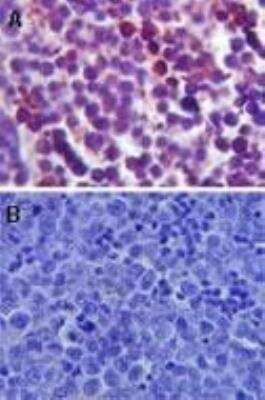 Immunohistochemistry-Paraffin: TLR4 Antibody - BSA Free [NB100-56581]