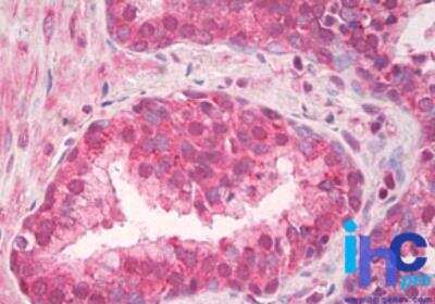 Immunohistochemistry-Paraffin: TLR4 Antibody - BSA Free [NBP2-24538]