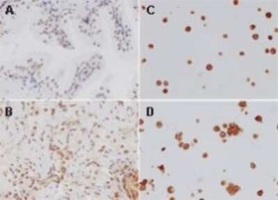 Immunohistochemistry-Paraffin: TLR4 Antibody [NBP2-24821]