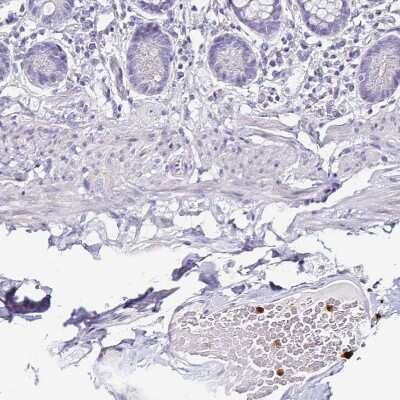 Immunohistochemistry-Paraffin: TLR4 Antibody [NBP2-47604]