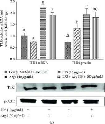 Western Blot: TLR4 AntibodyBSA Free [NBP2-24538]