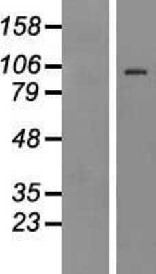 Western Blot: TLR4 Overexpression Lysate [NBP2-05647]