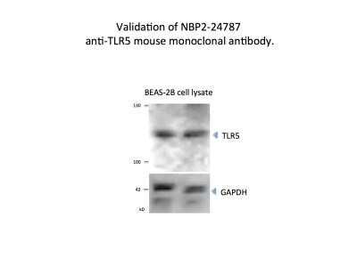 Western Blot: TLR5 Antibody (19D759.2)Azide and BSA Free [NBP2-80981]