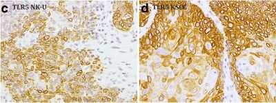 Immunohistochemistry: TLR5 Antibody (19D759.2) - BSA Free [NBP2-24787]