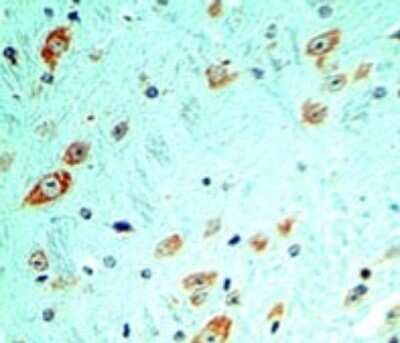 Immunohistochemistry-Paraffin: TLR5 Antibody (19D759.2) - BSA Free [NBP2-24787]