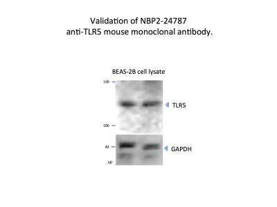 Western Blot: TLR5 Antibody (19D759.2)BSA Free [NBP2-24787]