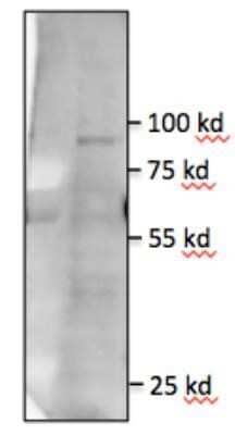 Western Blot: TLR5 Antibody (85B152.5)Azide Free [NBP2-33253]