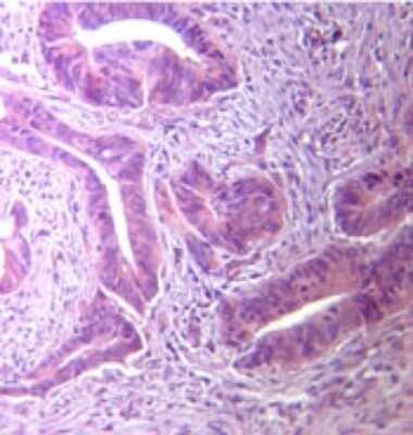 Immunohistochemistry-Paraffin: TLR5 Antibody [NBP2-24827]