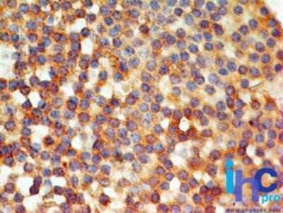 Immunohistochemistry: TLR6 Antibody (86B1153.2) - Azide Free [NBP2-37704]